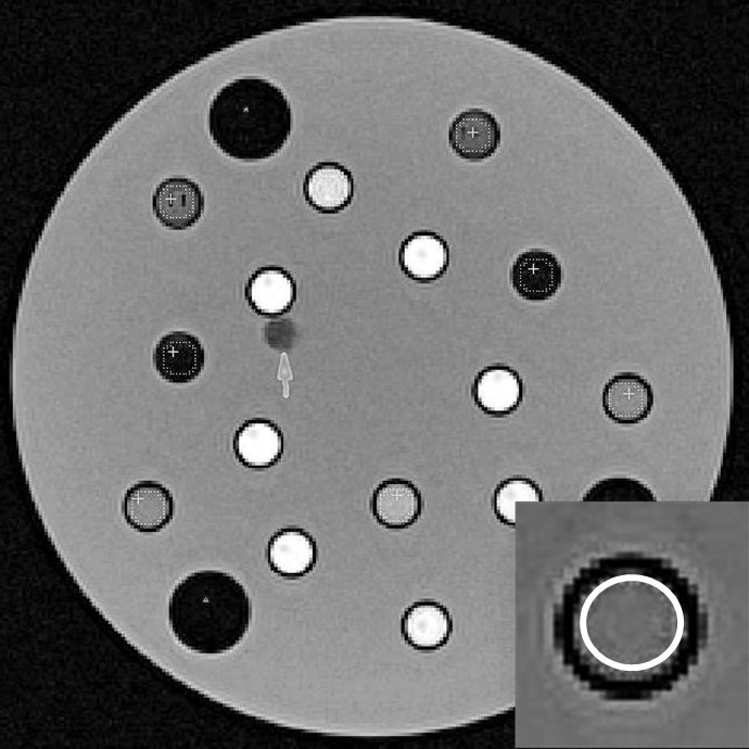 MRI Phantom Relaxivity Study