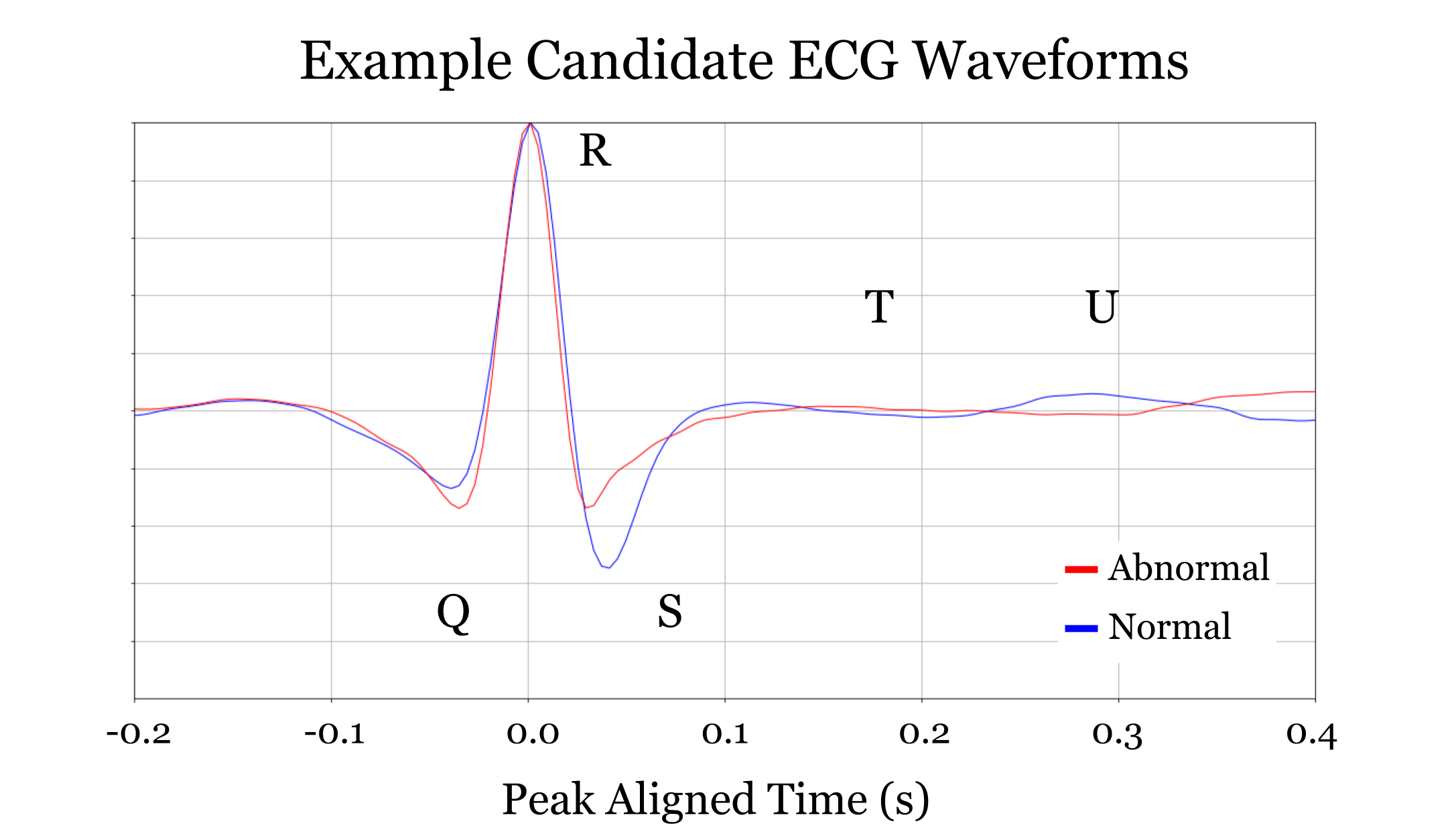 Single ECG Signal Rendering