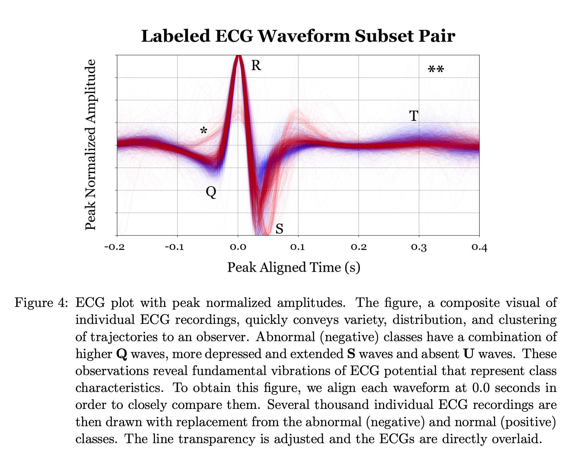 Example Interpretation of Classifier from Waveform Illustration