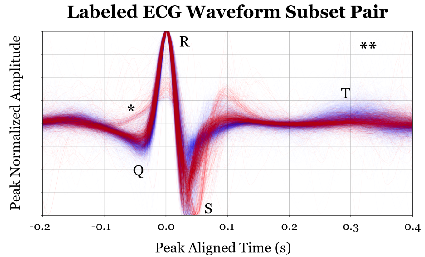 (Many) ECG Signals Dataset Rendering