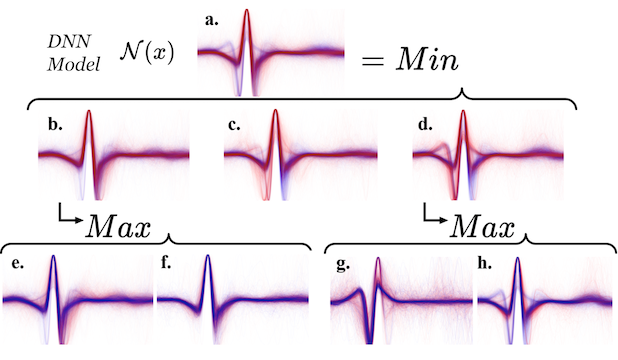 Interpretable Factorization of ECG AI Classifiers